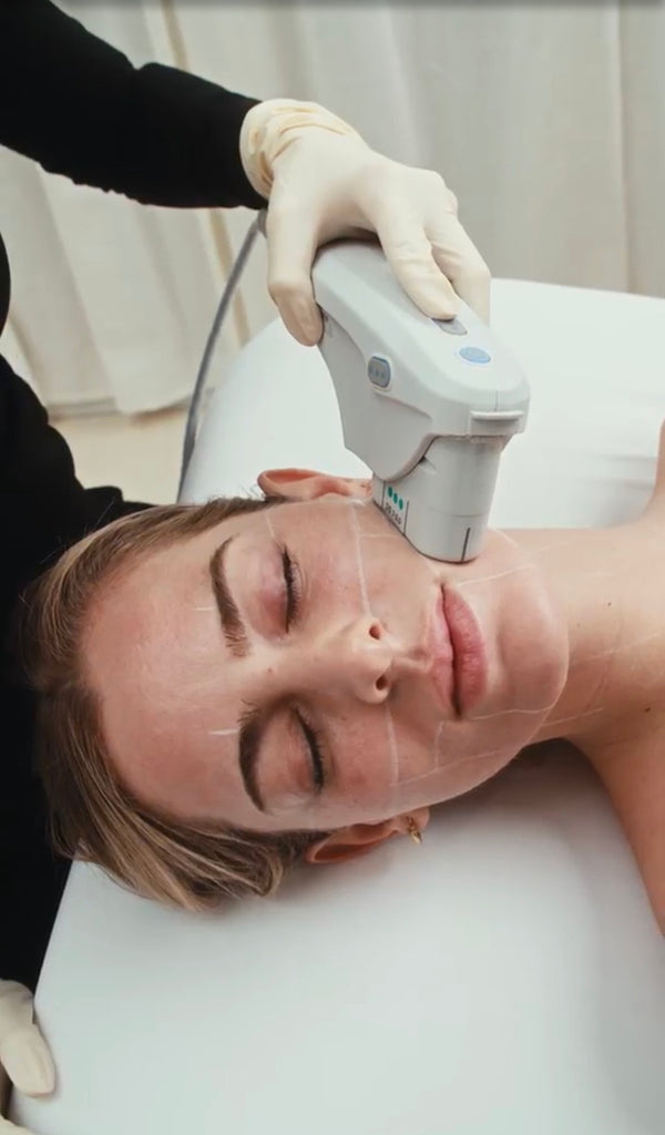 ULTHERAPY IS THE SUMMER TREATMENT