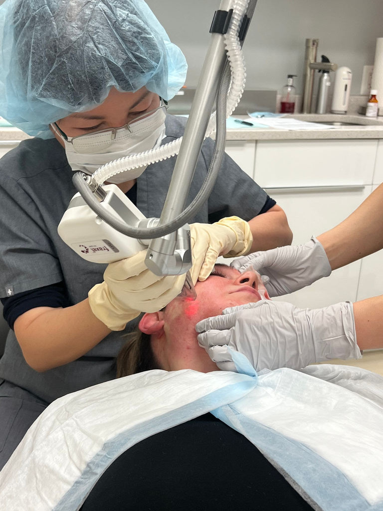 CO2 BEFORE & AFTER; BATTLING ACNE SCARS