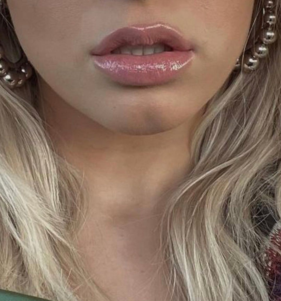 PLUMP YOUR LIPS FAST WITH OUR BOTOX LIP FLIP